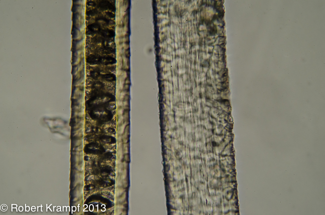long structures under a microscope