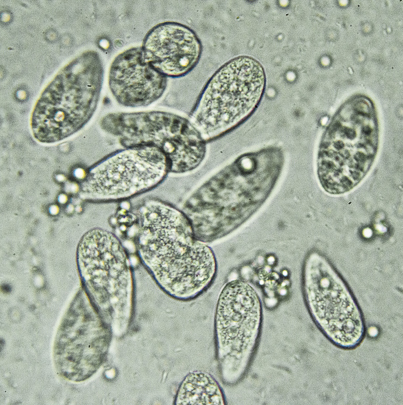ciliates under microscope